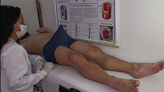 Thumbnail for Nurse Observes Patient's Erection